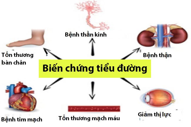 Chia tay bệnh tiểu đường